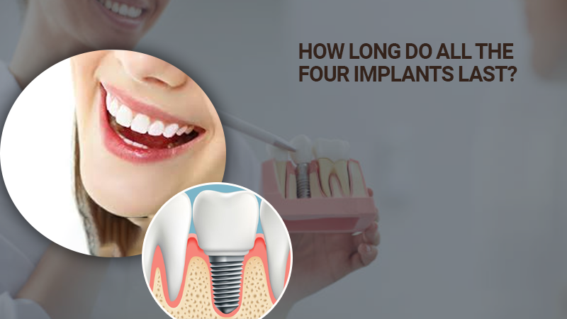 how-long-does-all-four-implants-last